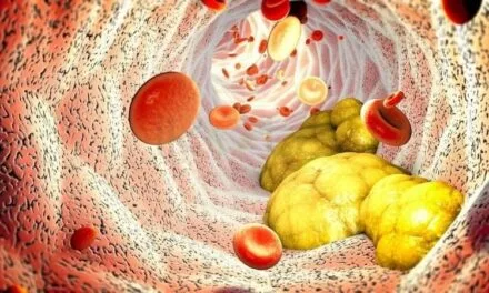 5 Loại Rau Bổ Trợ Tốt Cho Người Mắc Hội Chứng Chuyển Hóa