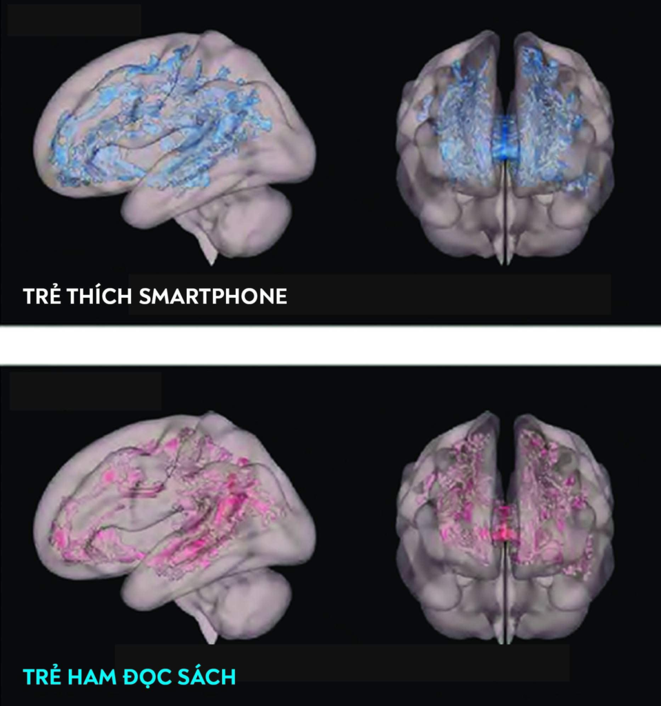 Sự Khác Biệt Rõ Rệt Trong Bộ Não Trẻ Nghiện Smartphone Và Trẻ Ham Đọc Sách