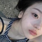 Da dầu không còn là nỗi sợ vì “Thần dược vàng” sẽ là giải pháp dành cho bạn