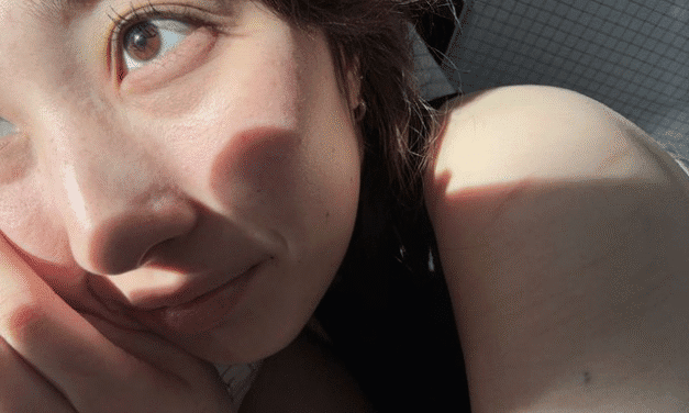 5 Thực Phẩm “Kem Chống Nắng Từ Bên Trong” Giúp Ngừa Sạm Da, Chống Lão Hóa Hiệu Quả Mùa Nắng Nóng