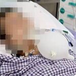 Ngộ Độc Botox Khi Tự Tiêm Tại Nhà: Nguy Hiểm Chết Người Cần Cảnh Giác