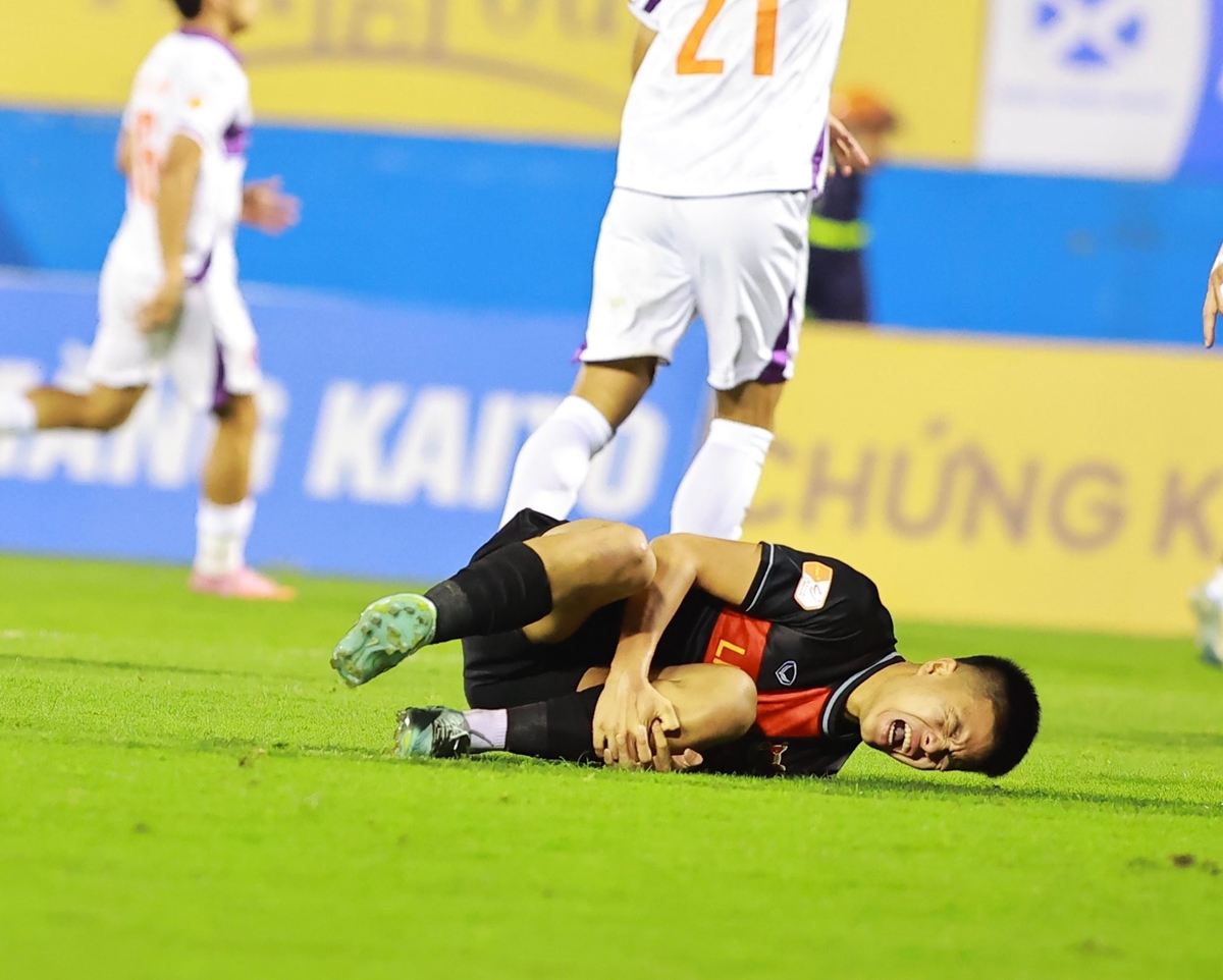 u22-viet-nam-nhan-tin-vui-tu-xuan-bac-chan-thuong-nhe-san-sang-cho-tran-gap-u22-malaysia-1