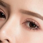 Cắt mí mắt sưng đau: khi nào cần lo lắng và đi khám