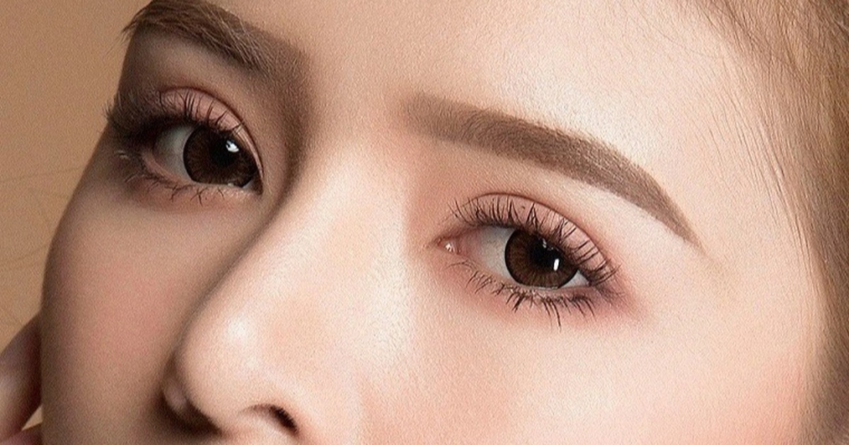 cắt mí mắt sưng đau: khi nào cần lo lắng và đi khám