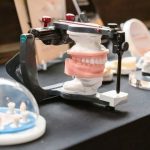 Công nghệ Nano Zirconia Hoa Kỳ: Răng sứ hoàn hảo tự nhiên